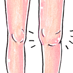 膝に水がたまる